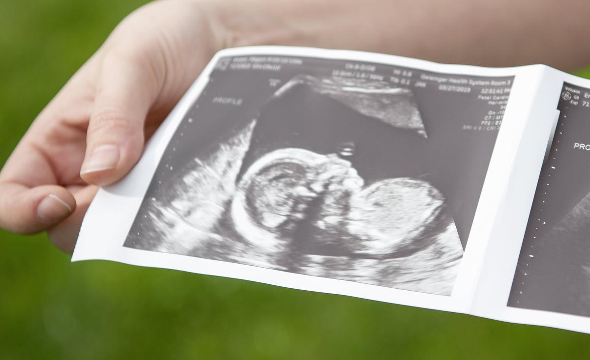 Megan Ensor holds ultrasound photos of the little boy her and her husband will welcome this summer.