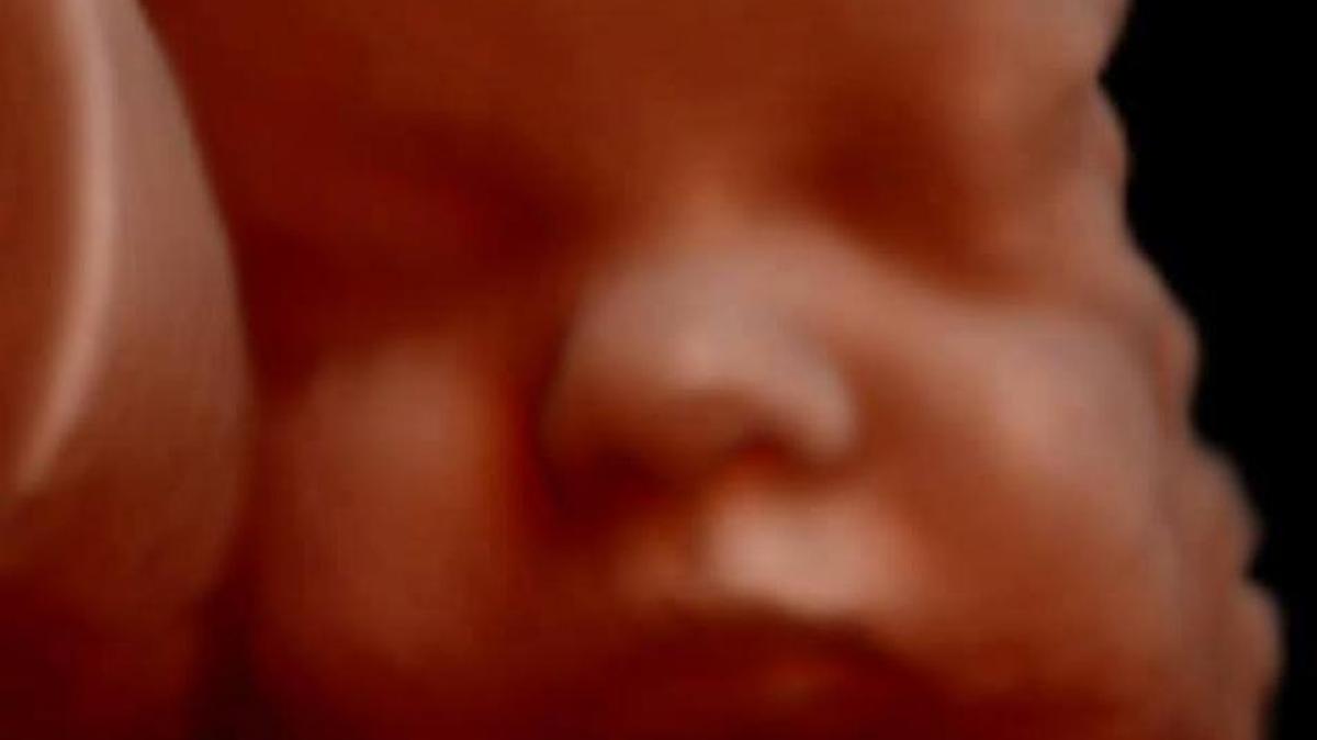 Elective ultrasounds, which have become more popular in recent decades, allow expecting parents to see more realistic images of their baby than older technologies have afforded.