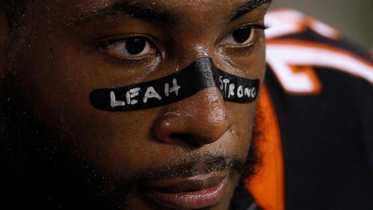 Cincinnati Bengals defensive tackle Devon Still sits on the bench with "Leah Strong" written on his face in the second half of a NFL preseason football game against the Chicago Bears, Saturday, Aug. 29, 2015, in Cincinnati. (AP Photo/Frank Victores)